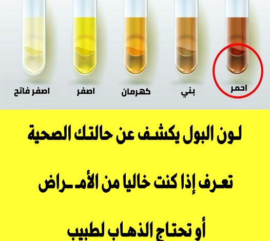 لون البول يكشف عن حالتك الصحية تعرف إذا كنت خاليا من الأمـ ـراض أو تحتاج الذهاب لطبيب