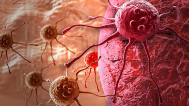 أعراض السـرطان الخطيرة التي تظهر قبل خمس سنوات من المـرض