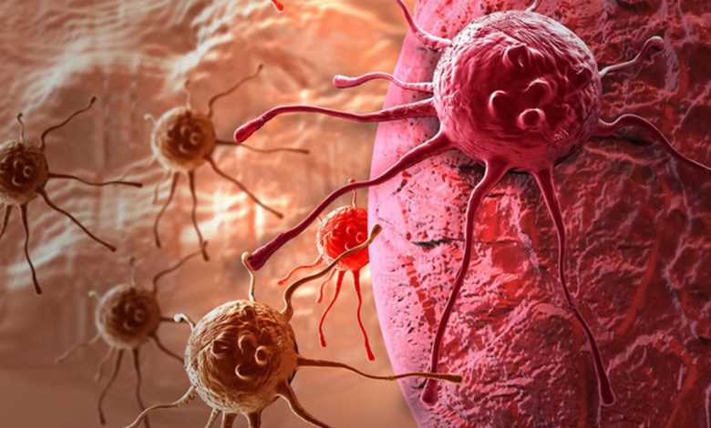 أعراض السـرطان الخطيرة التي تظهر قبل خمس سنوات من المـرض